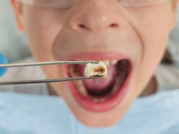 Best Emergency Orthodontic Services in Lawrencevle, IL